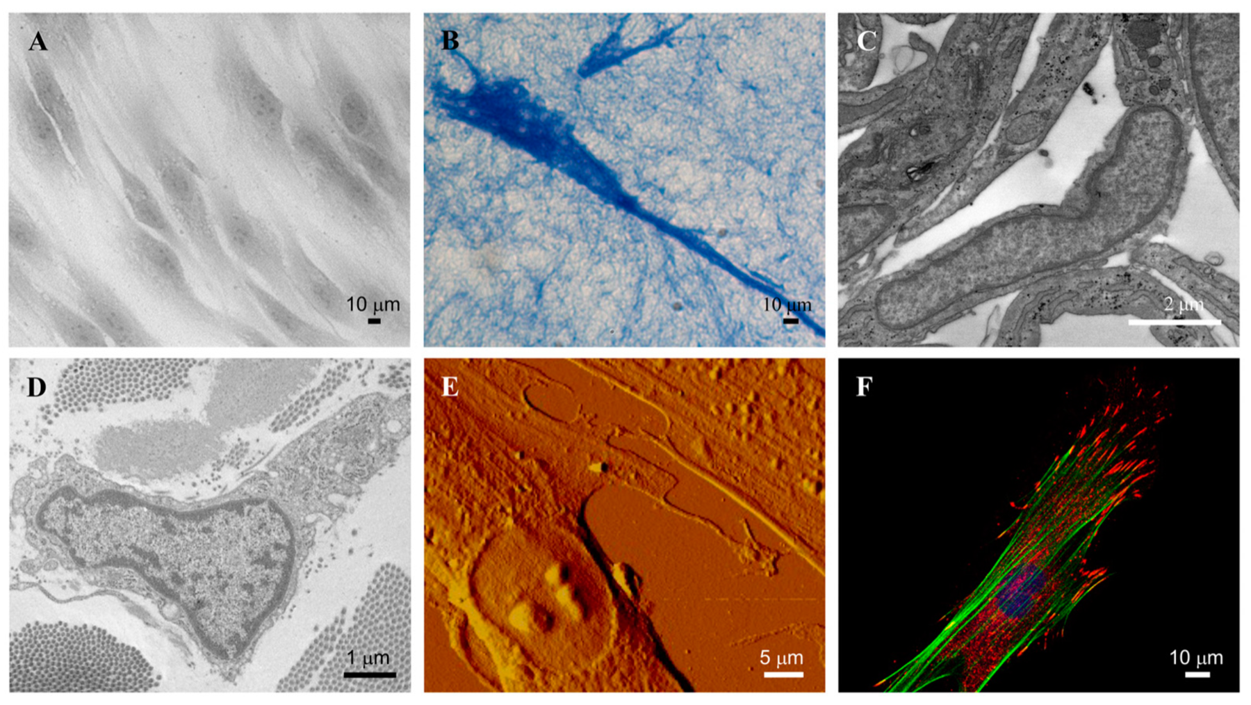 Microscopic view of fibroblast cells and extracellular matrix